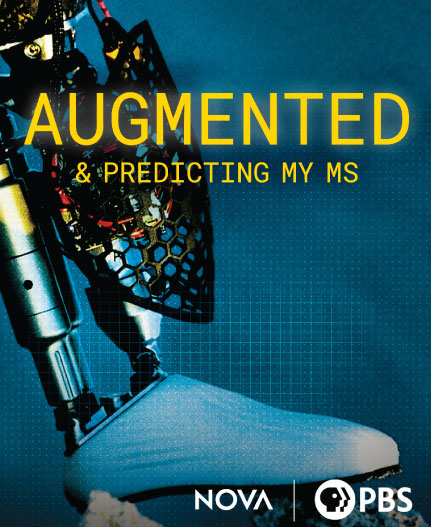 Augmented & Predicting My MS